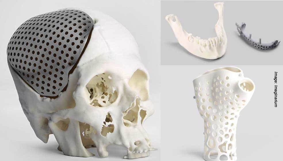 3D Printing in Medicine Field